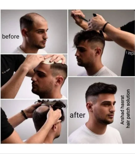 Men’s Hair Patch – Natural Look Hair Replacement System - Image 2